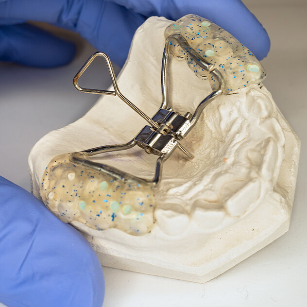 What is upper jaw expansion?