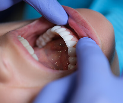 Complex jaw alignment