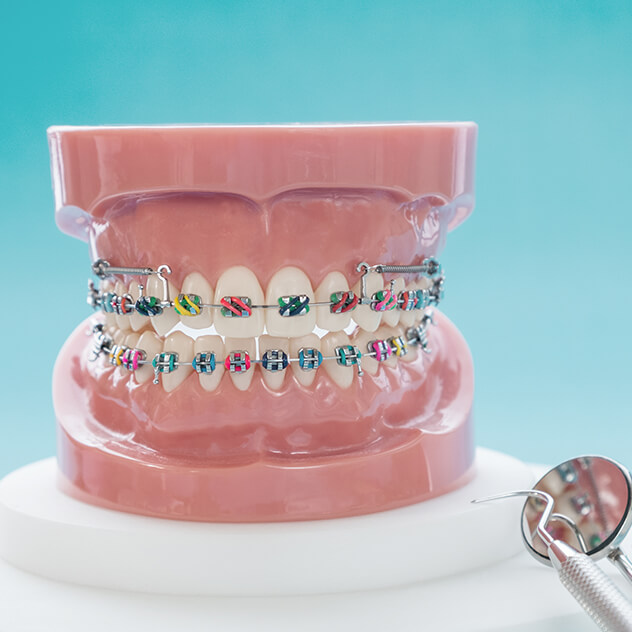 How metal braces work