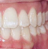 Before & Afters