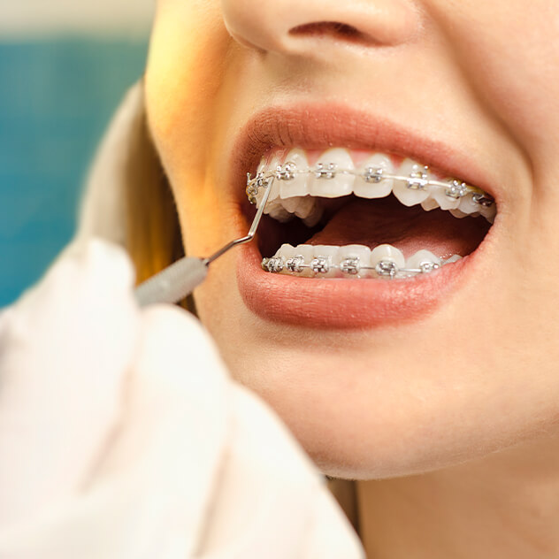 What to expect during treatment
