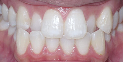 Before & Afters
